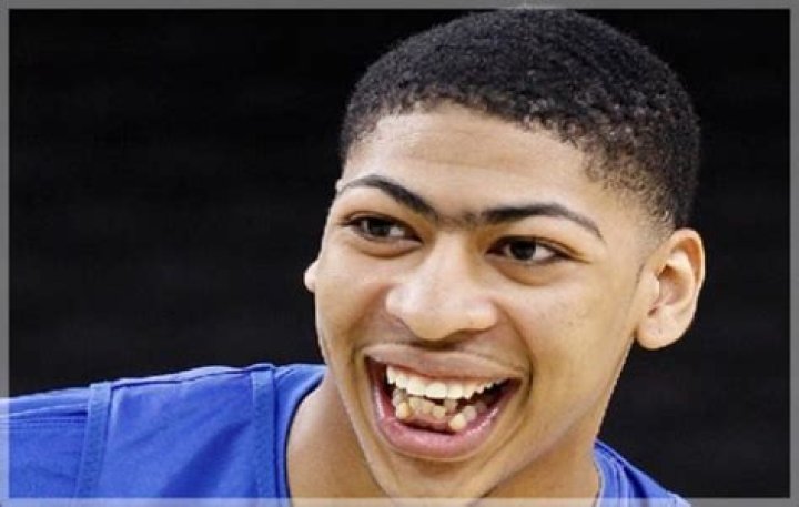 Anthony Davis' Teeth Transformation: Uncovering His Dental Journey
