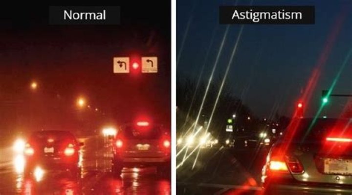 Unveiling The Mysteries Of Astigmatism Light Streaks: Discoveries And Insights