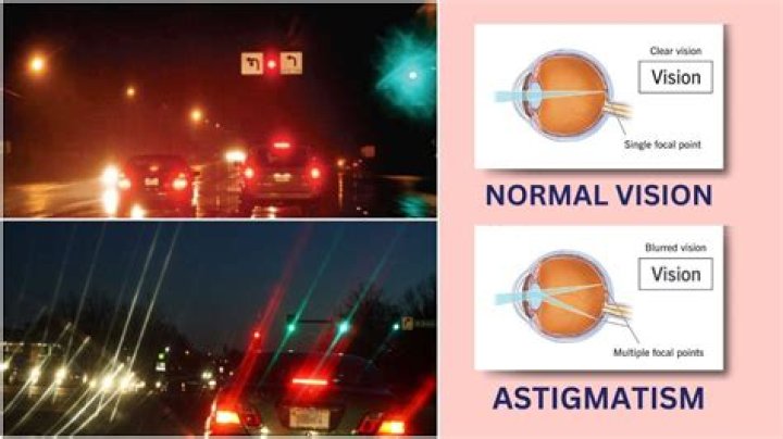 Astigmatism's Impact On Night Vision