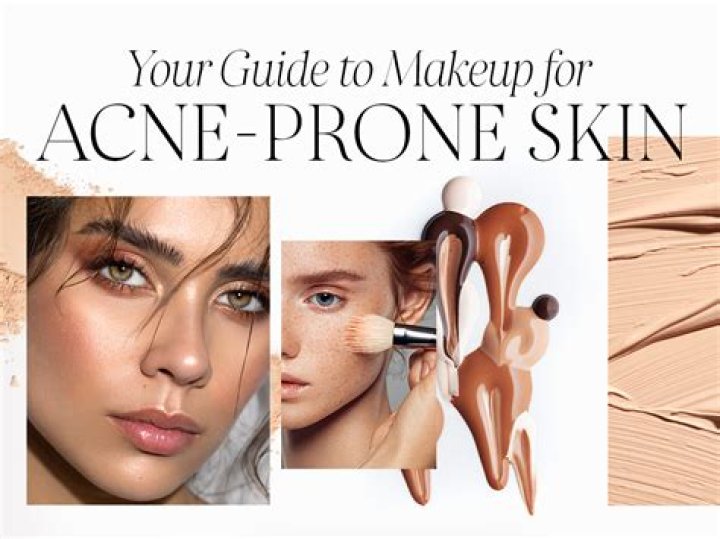 Discover The Holy Grail Of Makeup For Acne-Prone Skin