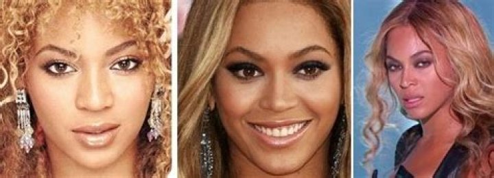 Unveiling The Truth Behind Beyonc's Breast Implants: Discoveries And Insights