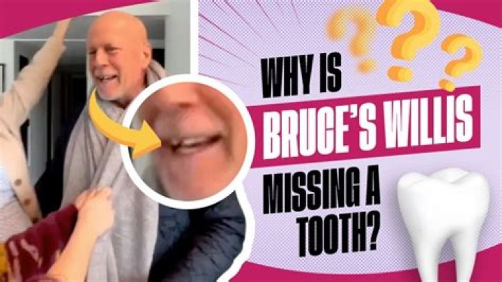 Bruce Willis' Missing Tooth: Unlocking Secrets And Insights