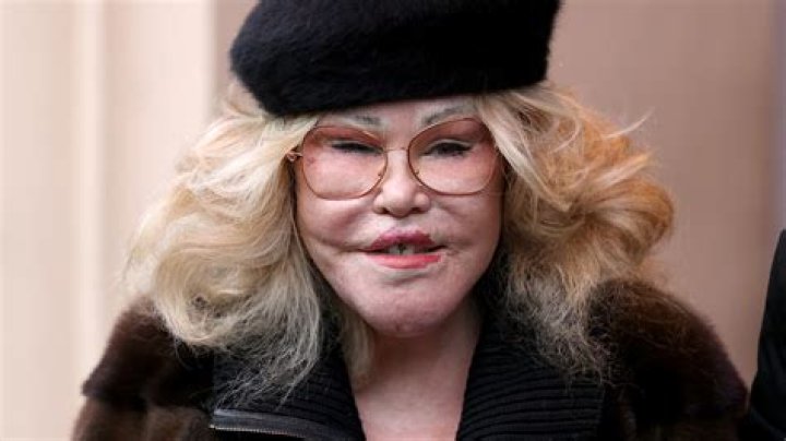 Unveiling The Enigma Of "Catwoman Wildenstein": Discoveries And Insights