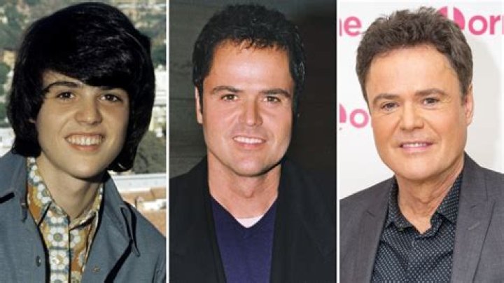 Donny Osmond's Plastic Surgery Journey