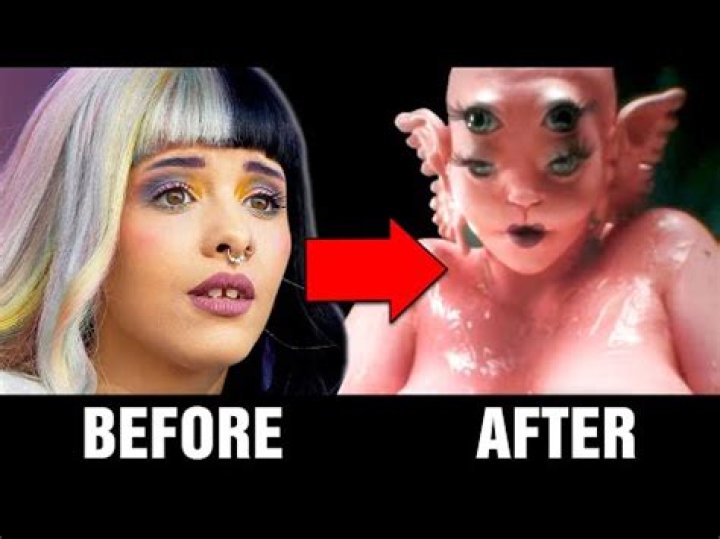 Unveiling Melanie Martinez's Plastic Surgery Enigma: Truth Revealed