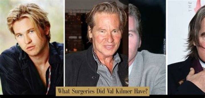 Unraveling The Enigma Of Plastic Surgery