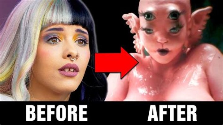 Melanie Martinez Plastic Surgery: Uncovering The Truth