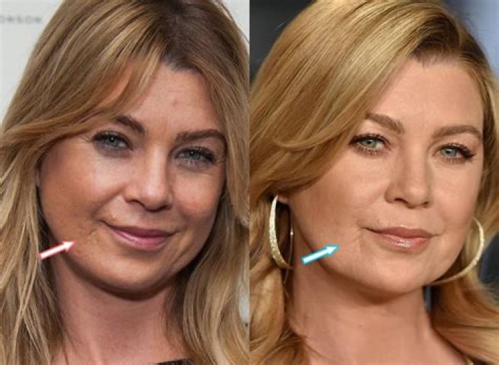 Unveiling Ellen Pompeo's Face Lift: Discoveries And Insights Revealed