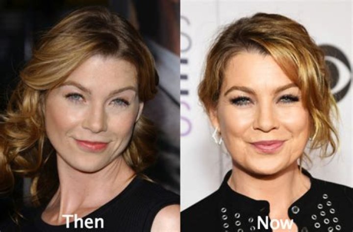 Unveiling The Secrets Of Ellen Pompeo's Surgery: Discoveries And Insights