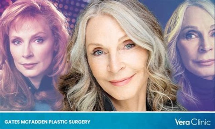 Gates McFadden's Plastic Surgery: Uncovering The Truths