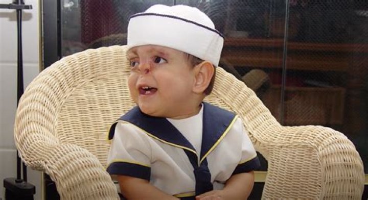 Unlock The Secrets Of Gray Canals: Discoveries And Insights