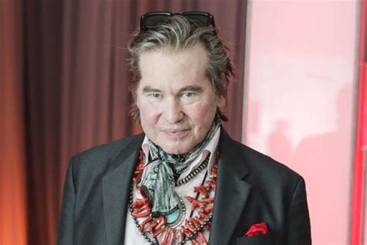 Val Kilmer's Plastic Surgery Journey