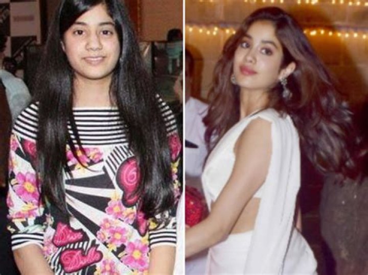 Janhvi Kapoor Before Surgery: Unveiling Beauty's Evolution