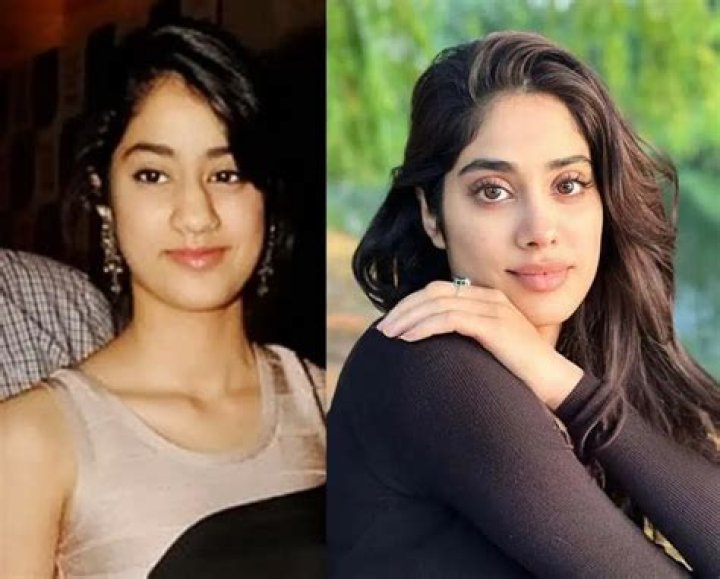 Unveiling Janhvi Kapoor's Plastic Surgery Secrets: Insights And Revelations