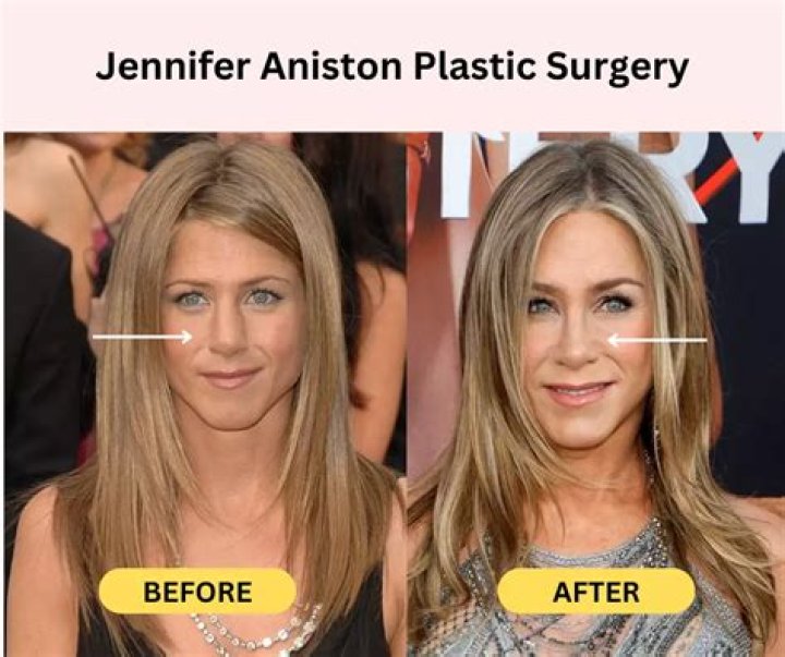 Before Plastic Surgery And Beyond