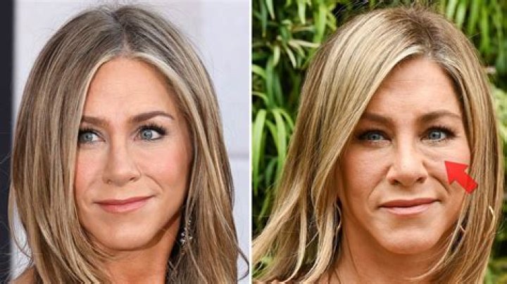 Unveiling The Secrets Of The "Jennifer Aniston Face Lift": Discoveries And Insights