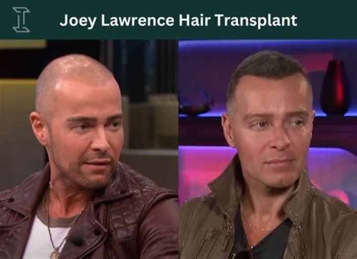 Unlocking The Secrets Of Joey Lawrence's Hair Restoration Journey