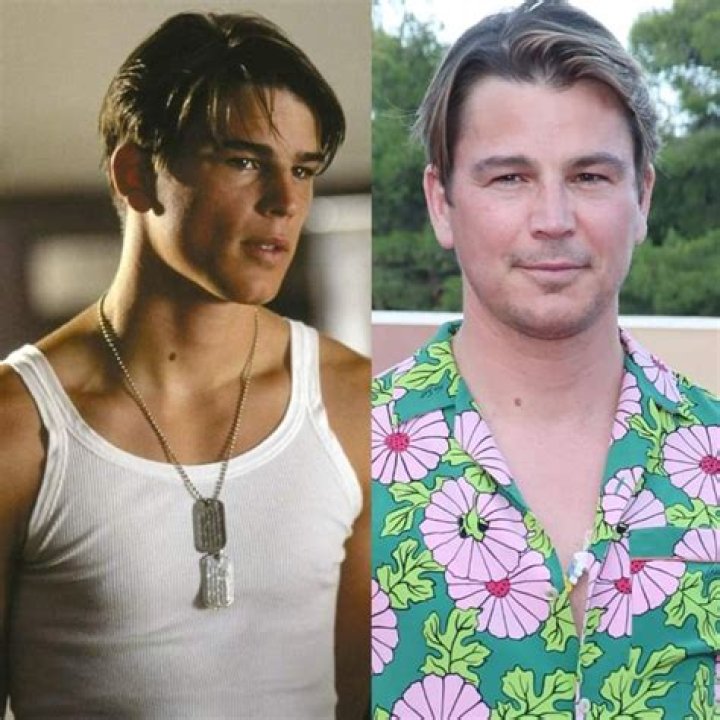 Josh Hartnett's Plastic Surgery Journey
