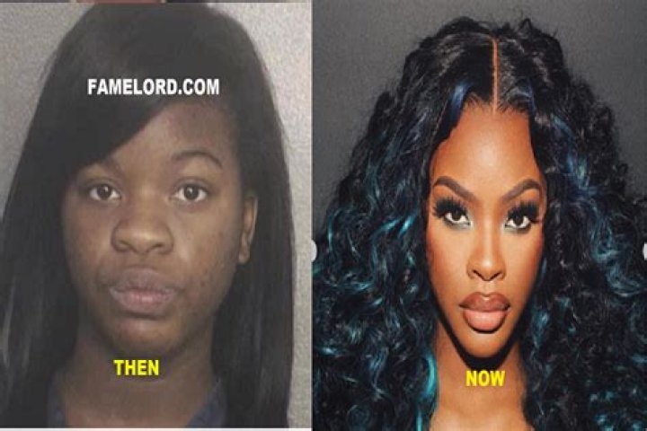 Discoveries From "Jt Before Surgery"