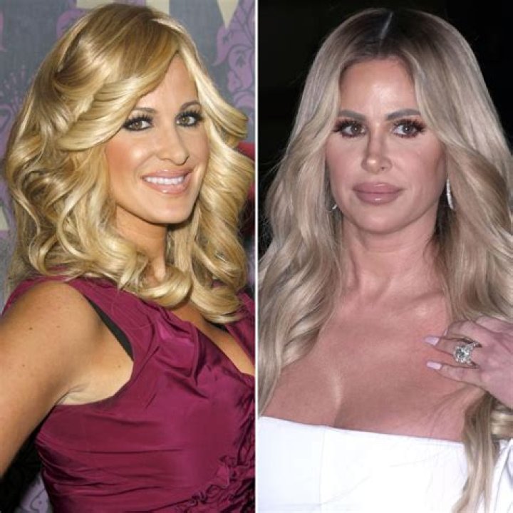 Kim Zolciak Before Plastic Surgery