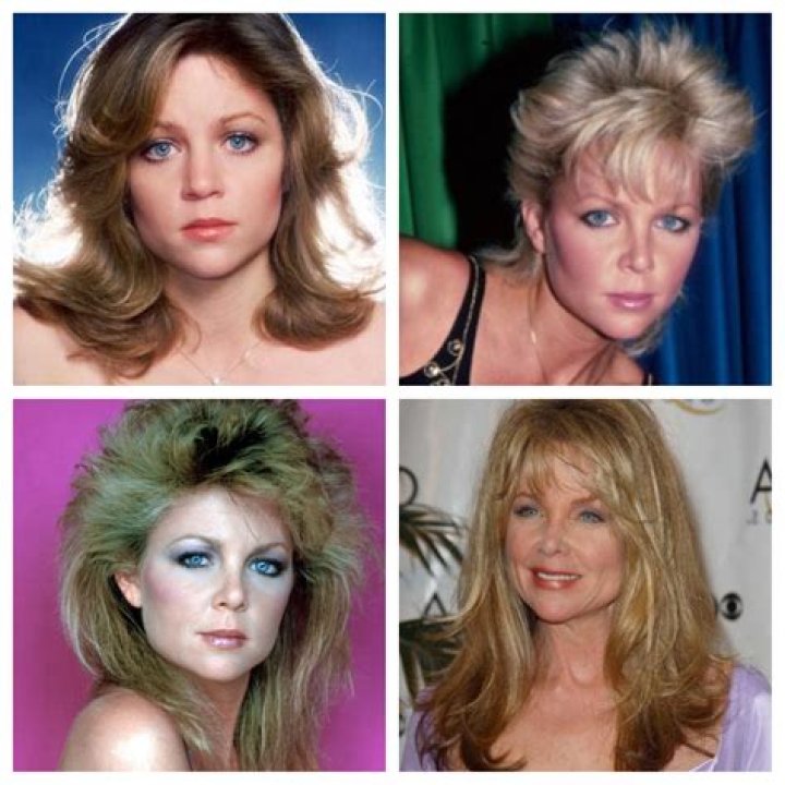 Unveiling Lisa Hartman Black's Plastic Surgery Secrets: Discoveries And Insights