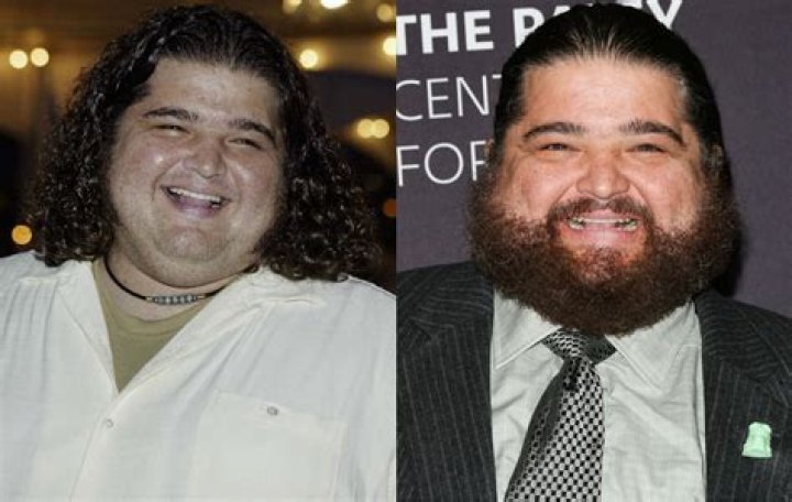 Unveiling The Enigmatic Lost Hurley Actor: A Journey Of Discovery