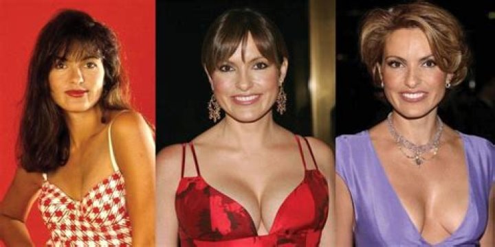 Mariska Hargitay's Plastic Surgery: Secrets Unveiled