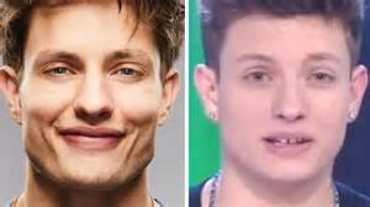 Unlocking The Secrets Of Matt Rife's Dental Transformation