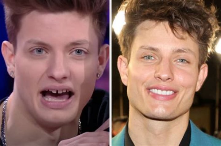 Uncover The Secrets Of Matt Rife's Captivating Dental Transformation