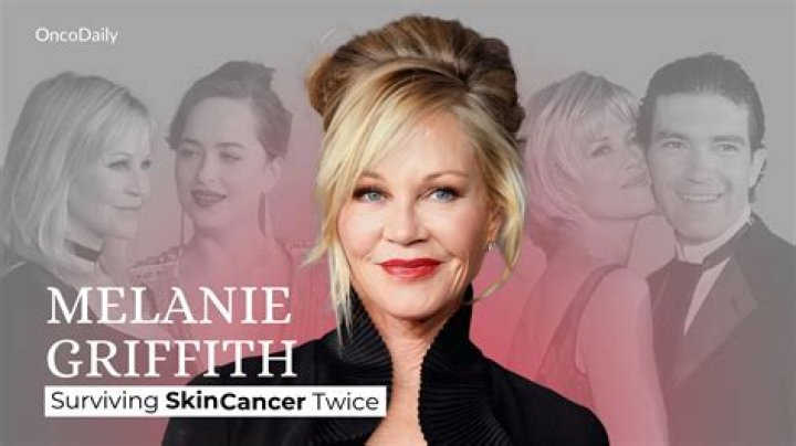 Melanie Griffith's Skin Cancer: Uncovering Surprising Insights