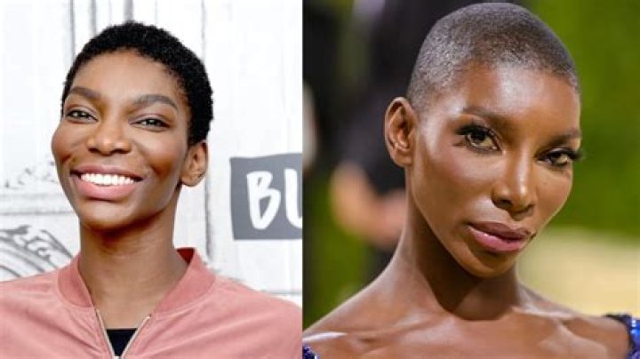 Michaela Coel's Surgery: Uncovering Hidden Truths