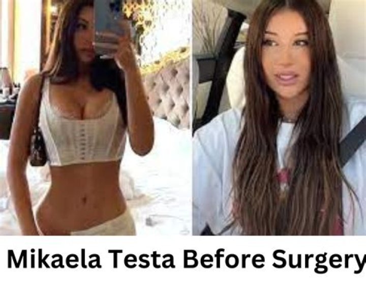 Mikayla Testa's Transformation Before Surgery