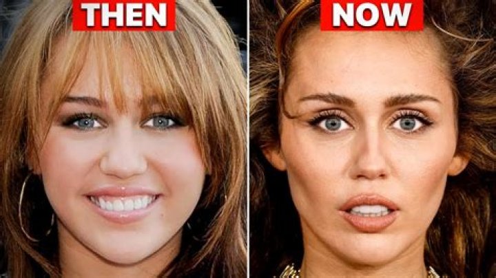 Unveiling The Secrets Of Miley Plastic Surgery: Discoveries And Insights