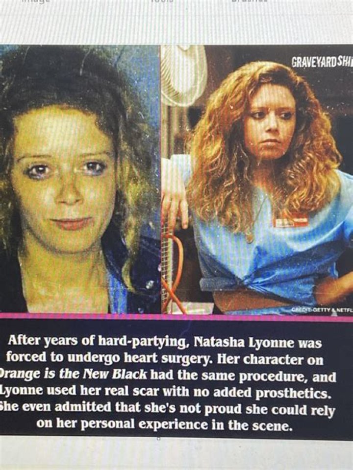 Natasha Lyonne's Scar And Its Profound Impact