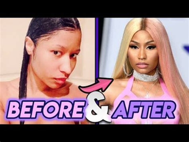 Unveil The Secrets Of Nicki Minaj's Signature Bleached Locks
