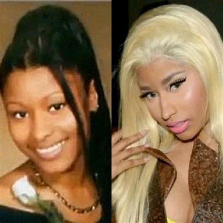 Unveiling The Dangers And Deceptions Of Nicki Minaj's Skin Bleach Journey