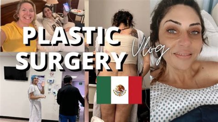 Unveiling The Secrets Of Plastic Surgery In Tijuana: Discoveries And Insights