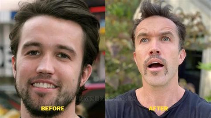 Unveiling The Secrets Of Rob McElhenney's Plastic Surgery Journey