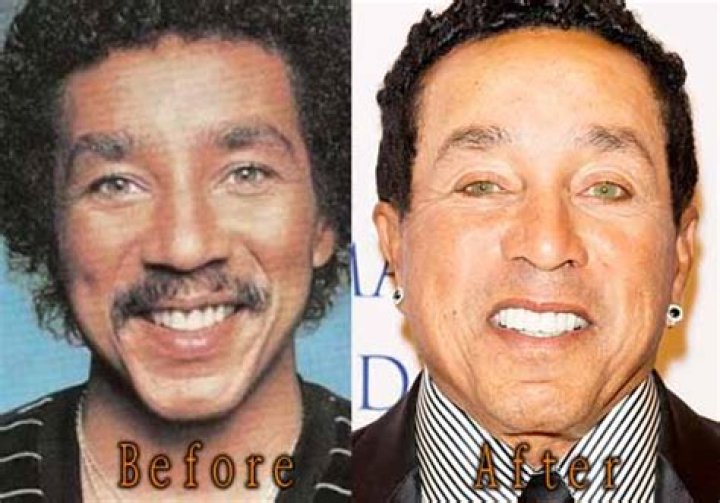 Smokey Robinson's Plastic Surgery Journey: Unlocking Secrets And Truths