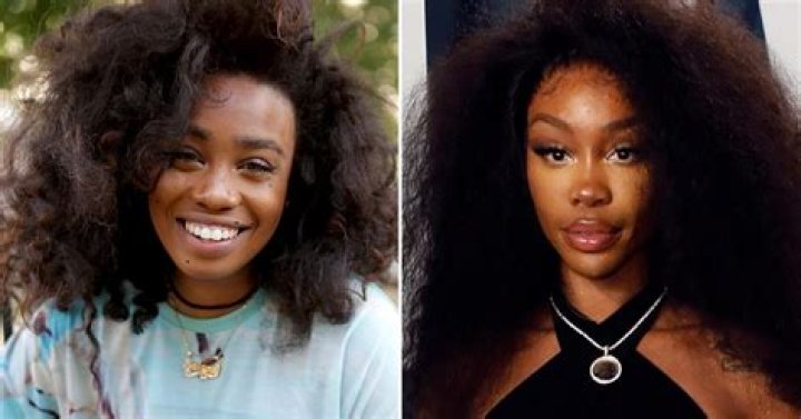 Unveiling SZA's Pre-Surgery Journey: Discoveries And Insights