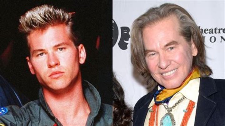Unveiling Val Kilmer's Cosmetic Journey: Discoveries And Revelations