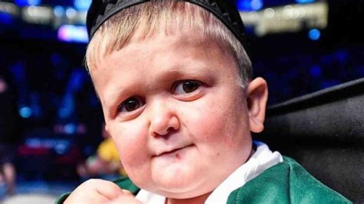 Unveiling The Mysteries: Hasbulla's Condition Explored