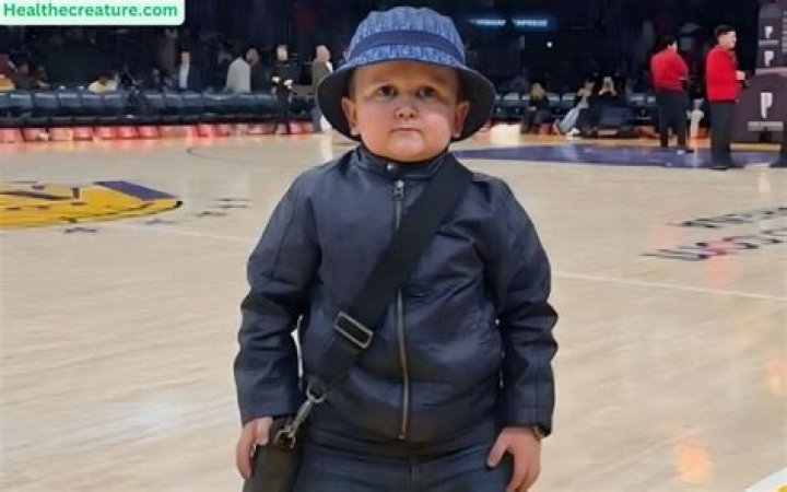 Unveiling The Enigma Of Hasbulla's Condition: Discoveries And Insights