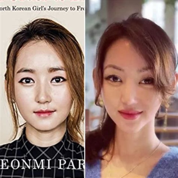 Unveiling Yeonmi Park's Plastic Surgery Journey: Insights And Discoveries