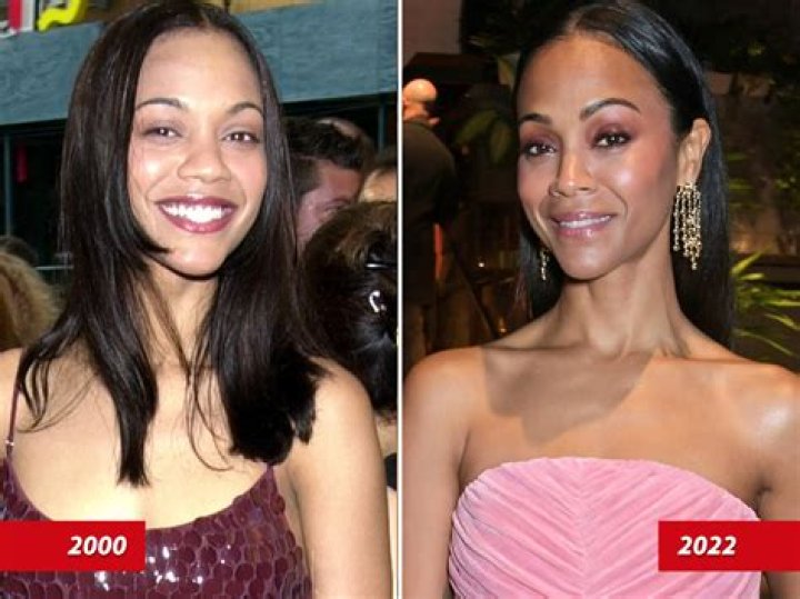 Zoe Saldana's Plastic Surgery: Unveiling The Transformation